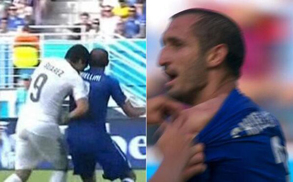 suarez-chiellini