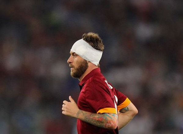 de-rossi-fasciatura-testa-roma-udinese-17-05-2015