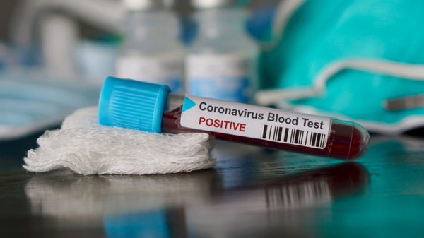 test-coronavirus